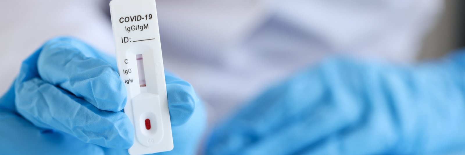 NHS Lateral Flow Test